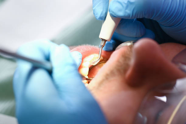 Best Emergency Denture Repair in Rainbow Springs, FL