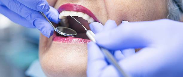 Best Emergency Root Canal Treatment in Rainbow Springs, FL